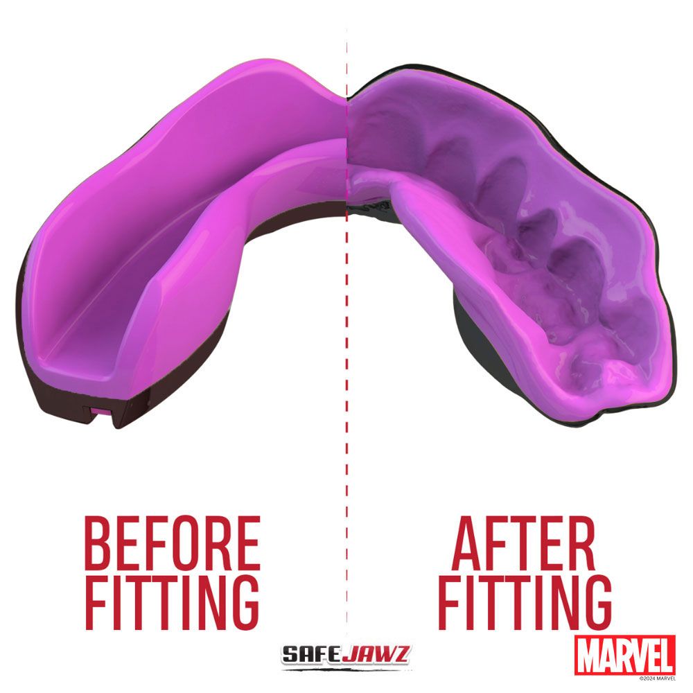 Zahnschutz „Extro Marvel“