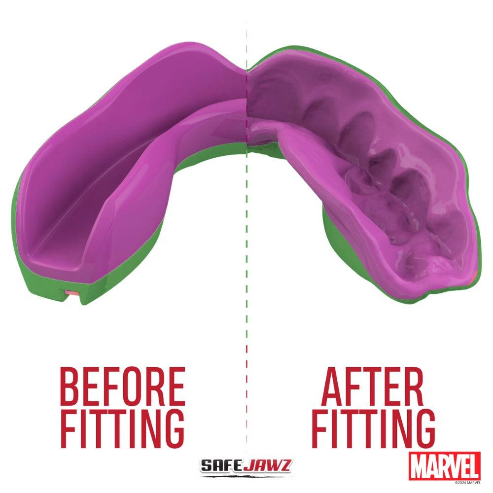 Zahnschutz „Extro Marvel“